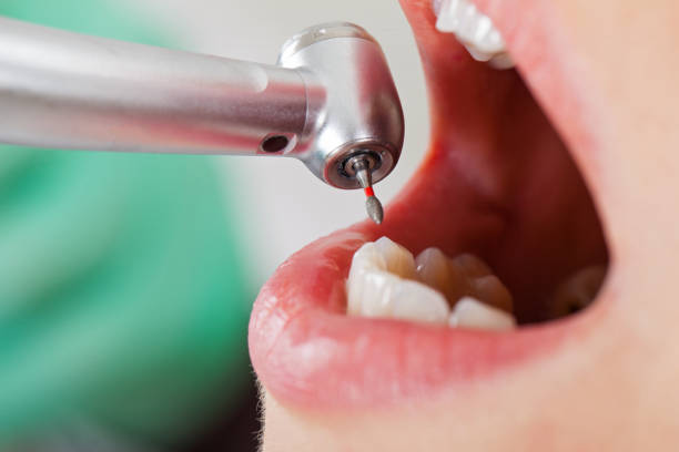 Best Emergency Dental Care for Broken or Chipped Teeth in Brinkley, AR